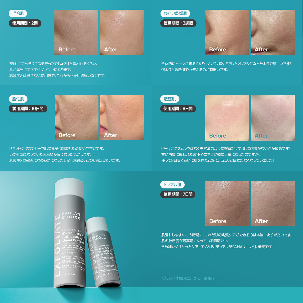 ちーさん専用　AZARE PURECALL MILD 60mL セラミエイド 薬用スキンミルク ミニサイズをプレゼント！: ｜ Maison